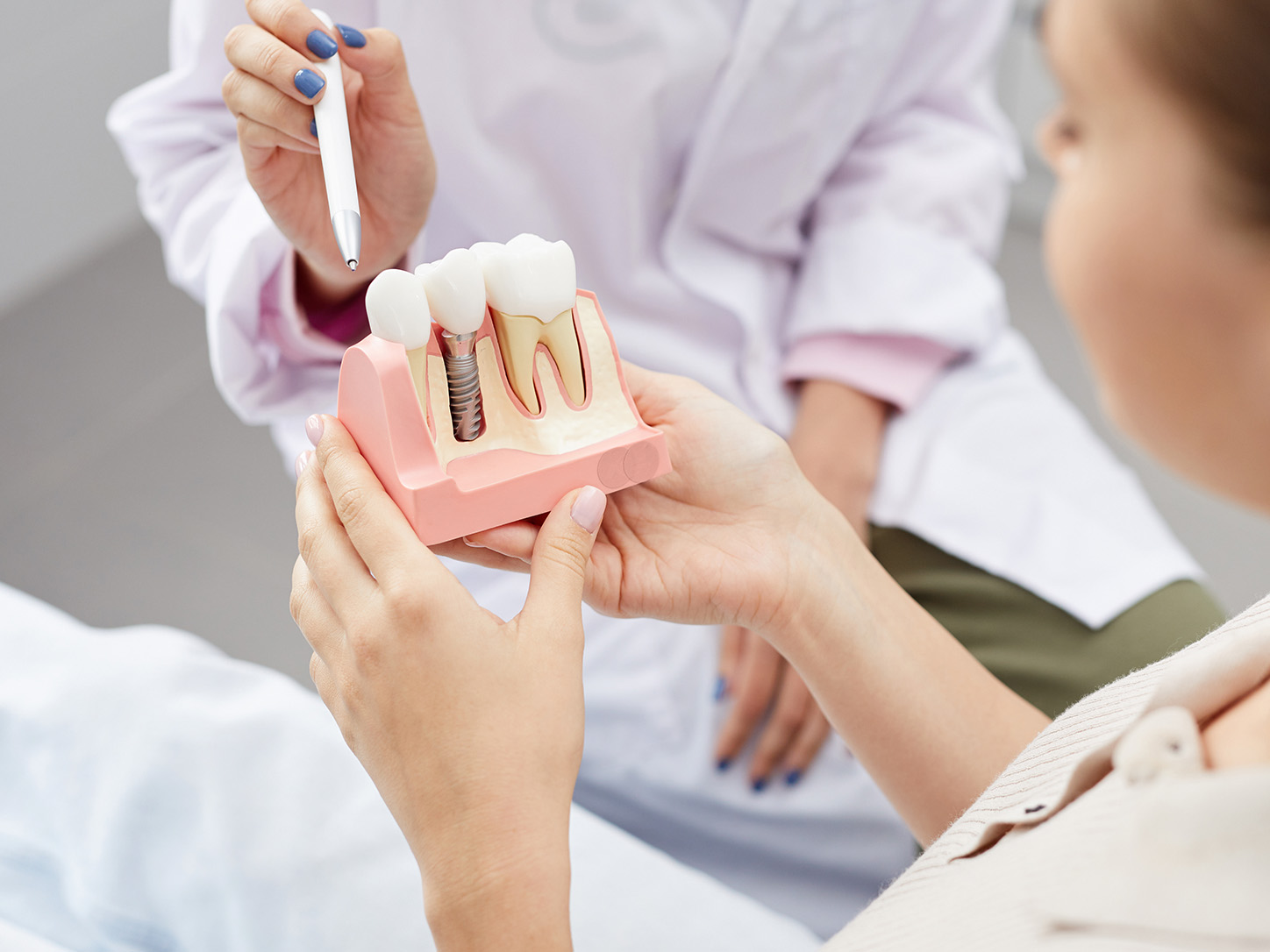 Dentist using an implant model to explain All-on-4 vs. traditional dental implants to a patient in Louisville, KY